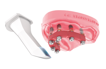 Reducing Uncertainty in the Digital Implant Workflow