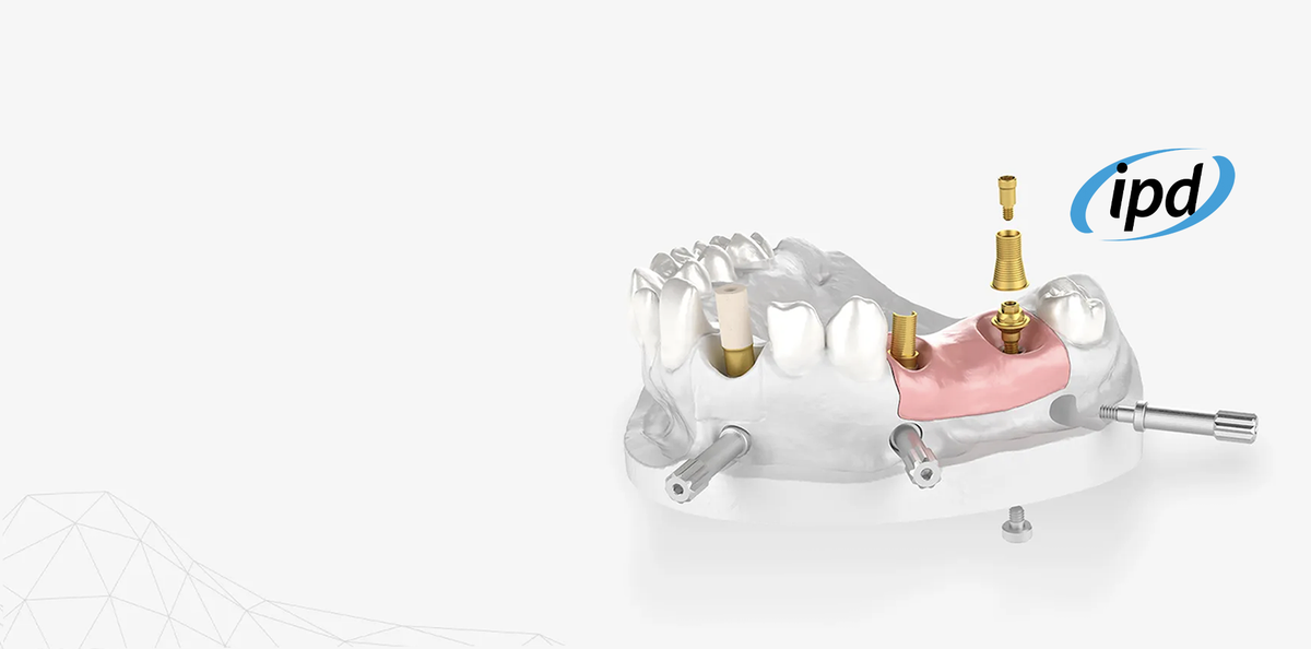 Online-Dental.uk IPD Compatible Dental Implant Components