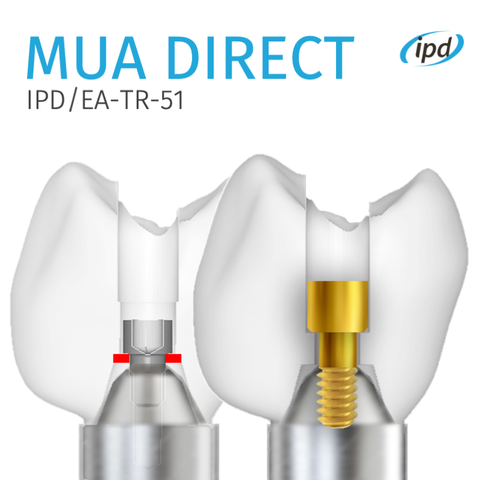 MUA Direct - A screw for direct-to-multi-unit restorations