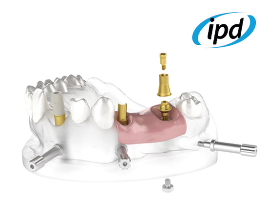 Online-Dental.uk IPD Compatible Dental Implant Components