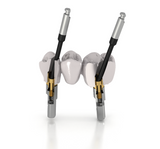 Sweden & Martina® Premium Kohno® compatible TPA screws for angled screw channels