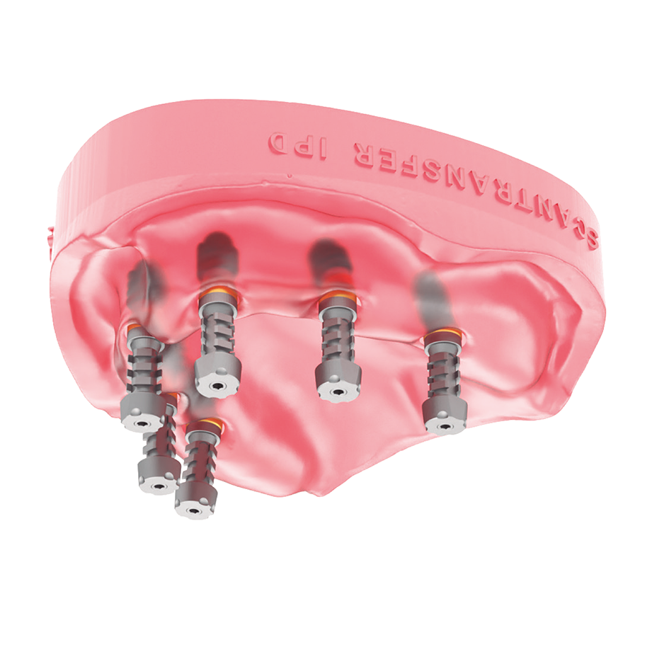 IPD Scan Transfer Abutment